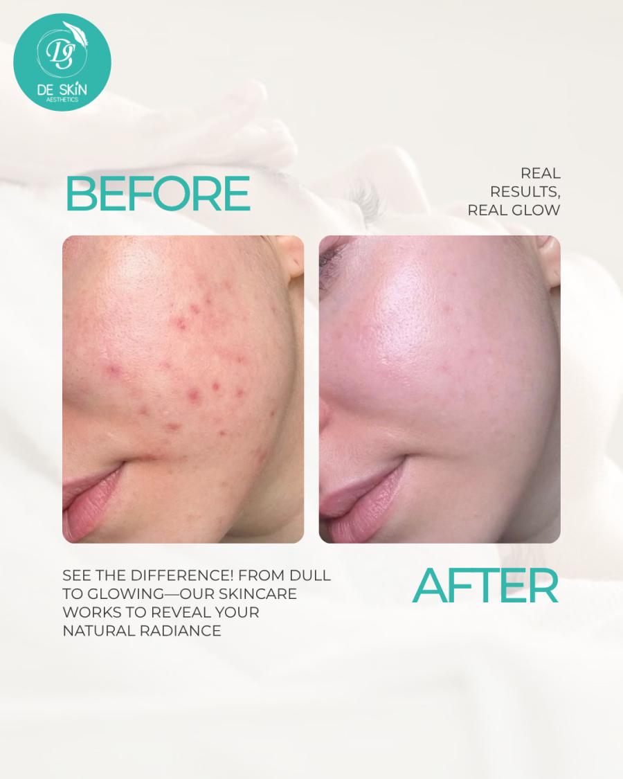 De Skin Aesthetics (Hougang)