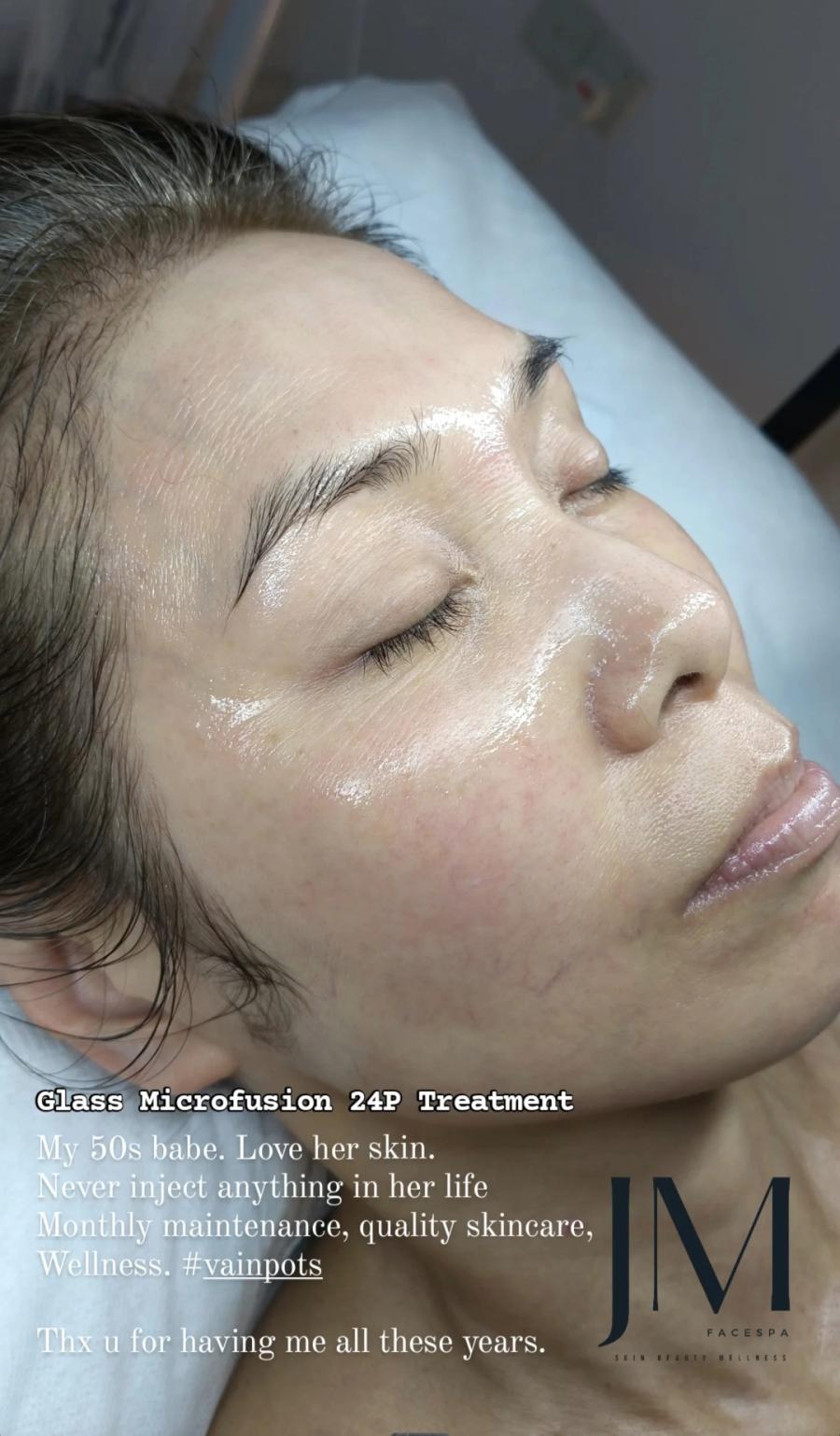 JM Facespa